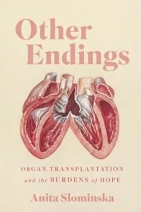 Other Endings